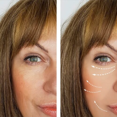 Hydranova Contorno Occhi: Il Segreto per uno Sguardo Fresco e Giovane